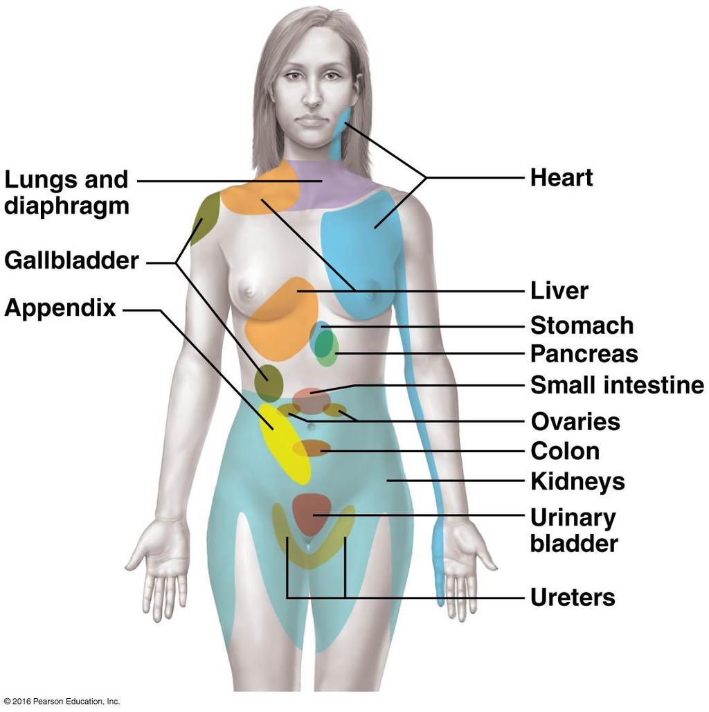 Referred Pain Pain stimuli arising from the viscera are perceived as somatic in origin.