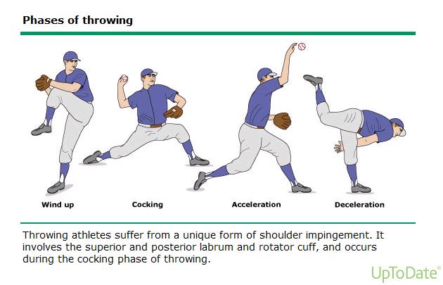 Impingement Symptoms are similar to RC tendinopathy Throwers may have pain and