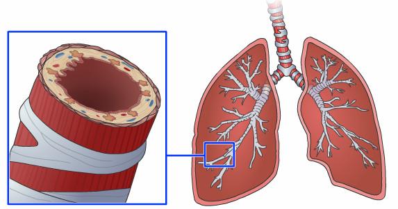 From the windpipe the air we breathe goes into a bunch of little passages called bronchial tubes. These are located on each side of the lungs. The smallest tubes are called Bronchial Tube bronchioles.