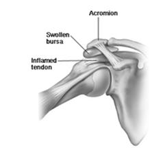 Dislocations Beware the frozen shoulder Be sure not missing posterior dislocation Physical Exam Pearl Even