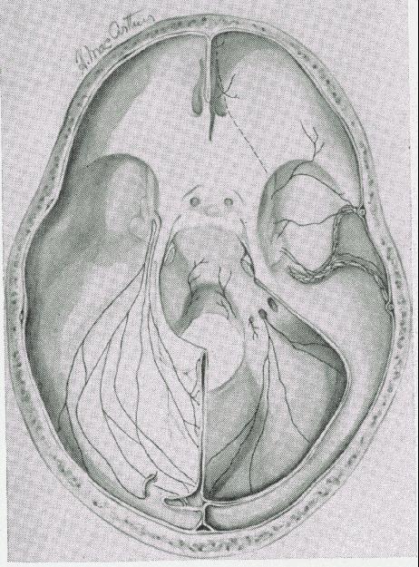The tentorial nerve