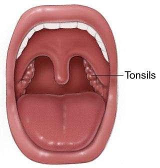 Tonsils Groups of lymphatic nodules and diffuse lymphatic tissue 3 groups of tonsils Palatine large oval shaped at oral cavity and pharynx