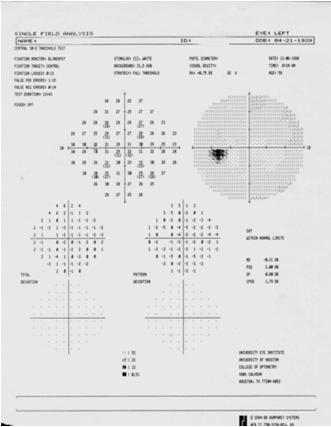 Meditec Visual Field Interpretation Methods of Data Presentation Systematic Strategy for Interpreting Visual Field / Recognizing Visual Field Loss Diagnostic Criteria for Glaucoma Classification of