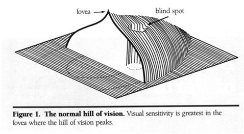 GLOBAL INDICES MEAN DEVIATION (MD) HEIGHT OF THE HILL OF VISION COMPARED TO AGE-MATCHED NORMALS PATTERN