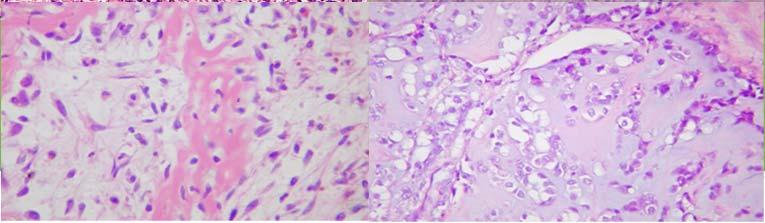 marker is wholly specific or sensitive for any given tumour In Sarcomatoid Neoplasms this Immunohistochemistry very limited Sarcomatoid Mesothelioma v Sarcomatoid Carcinoma v Sarcoma Inadequate