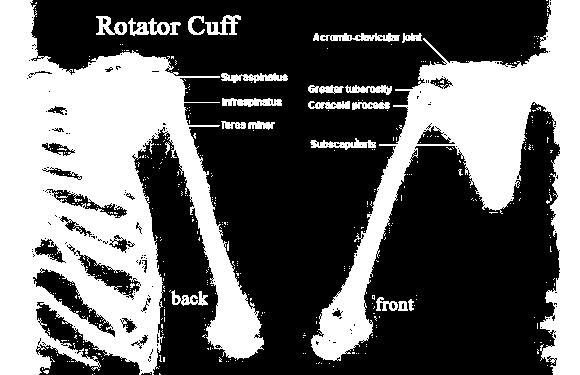 Arms (rotator cuff,