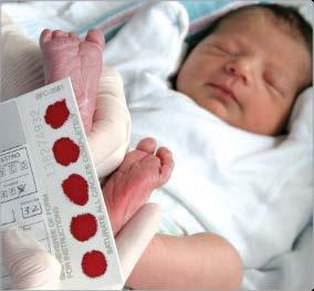 Newborn Screening worldwide: A quiet endeavour for 33 years, then multiplex testing Next Gen Sequencing!