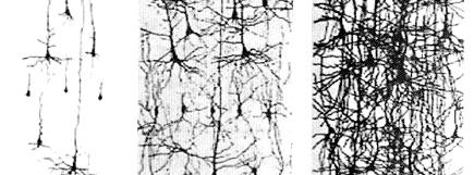 Brain development Makes networks Experience shapes the pathways Pruning: use it or lose it Brain connections for optimal development occur from: nurturing stimulation predictable care Cells multiply