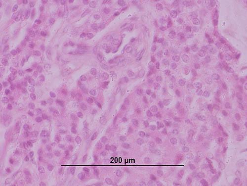 5. Parathyroid Gland a. Using the microscope and a histological slide of the parathyroid as your guide, draw and label the cells of the parathyroid gland in the picture be