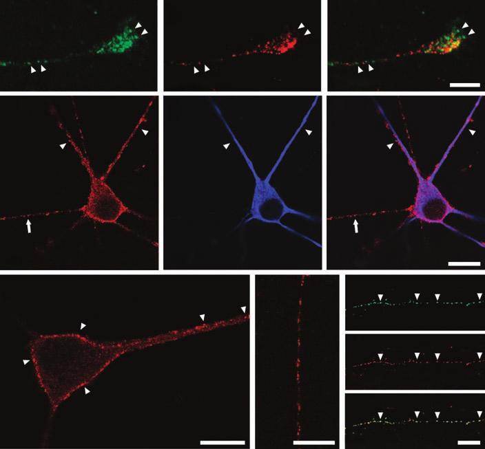Activity-Dependent Vesicular Trafficking of SemaA and dendrites. These data indicate that axons and dendrites regulate trafficking of SemaA and probably other secretory vesicles in distinct ways.
