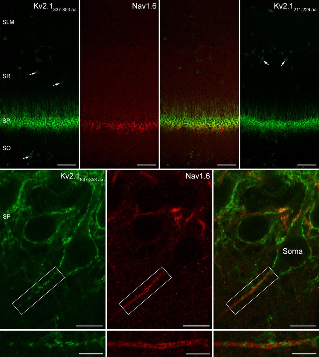 I Distributions of K + channel subunits in CA1 PCs 1777 A B C D E F G J K I J K Fig. 3. Immunofluorescent localisation of the Kv2.1 subunit in the CA1 region of the rat hippocampus.