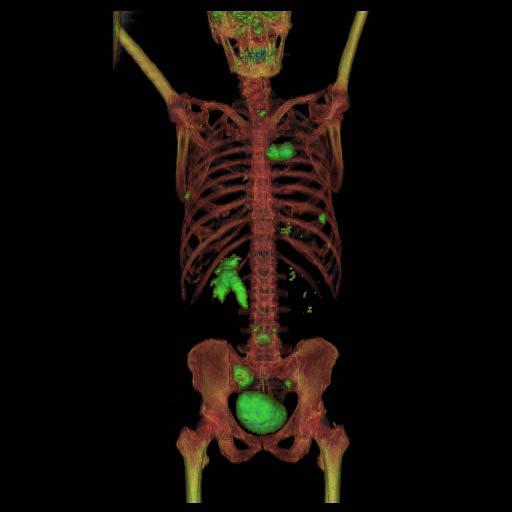 Improved Integration of PET and CT Scanners now support