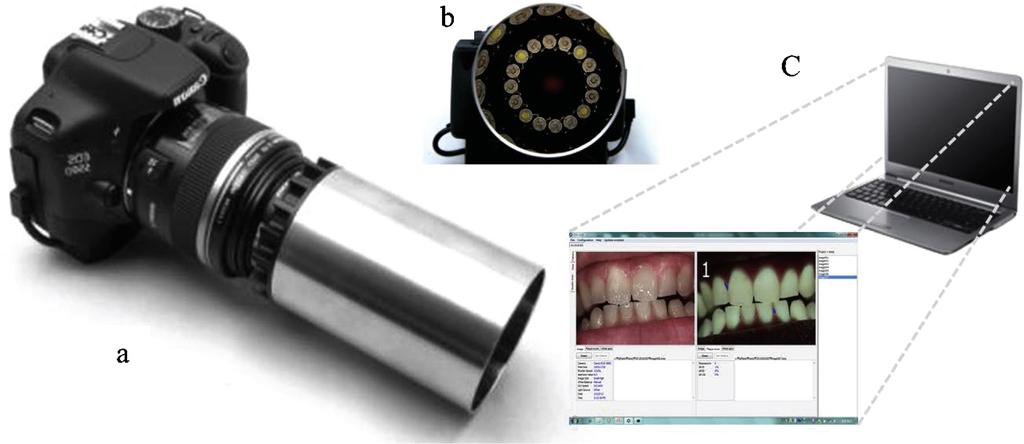 Monitoring of enamel caries by QLF-D and spectrophotometer 379 Introduction Early caries lesions are clinically observed as a white opaque spot.