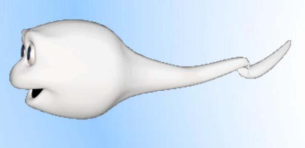 TESE: Testis Sperm Extraction Robert D. Oates, M.D., F.A.C.