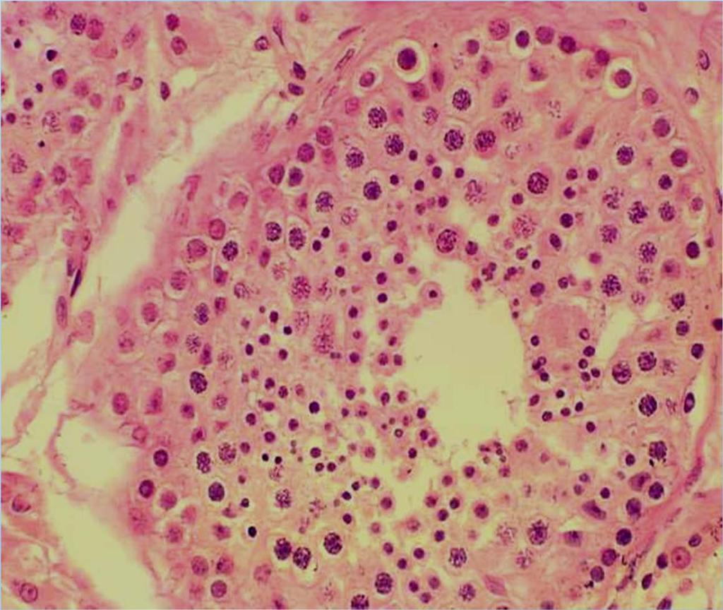 Spermatogenesis: Cell Types Spermatogonia