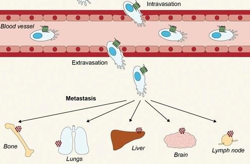 Figure 11: CXCR4 over-expression favors cancer spreading via blood circulation (adapted from 58) All these