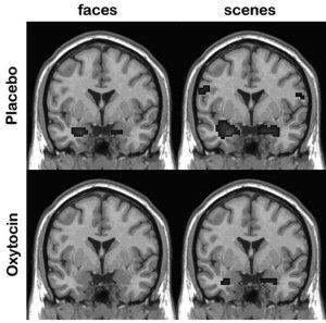 fear hub, the amygdala (and its associated brainstem relay stations), in response to