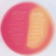 Differential and Selective Media: Mannitol Salt Agar henotypic Methods: