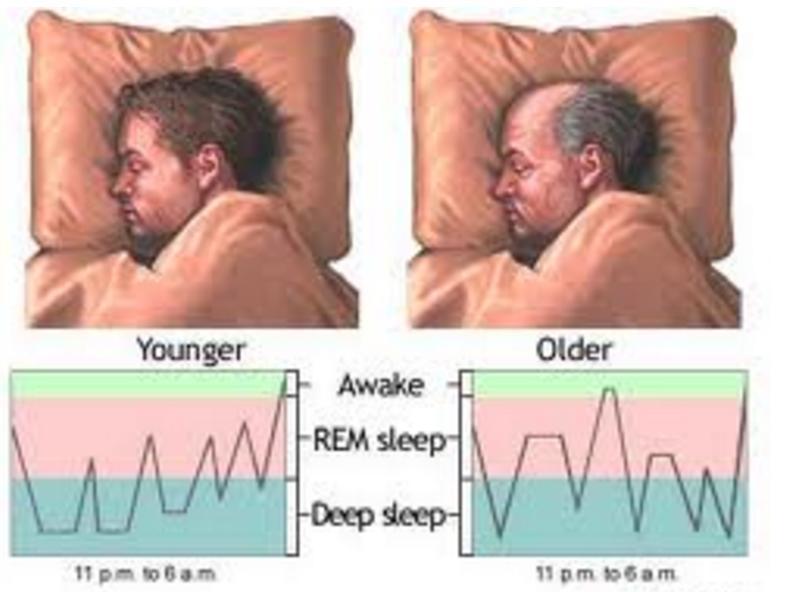 Sleep Changes with normal aging Increased nocturnal awakening. Sleep is less efficient.