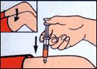 Remove air by holding syringe with needle upwards, tapping side gently, and slowly depressing plunger until a few drops appear at end of needle. This makes 1 ml of GlucaGen.