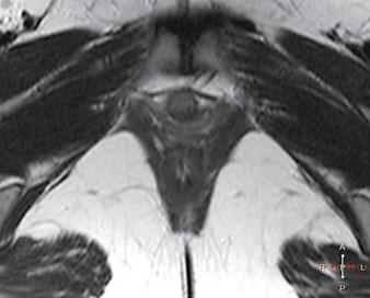 66 R.F. El Sayed a b c Fig. 4 a-c. Static T2-weighted magnetic resonance images (MRI) acquired at rest summarize components of the pelvic support systems assessed in static MRIs.