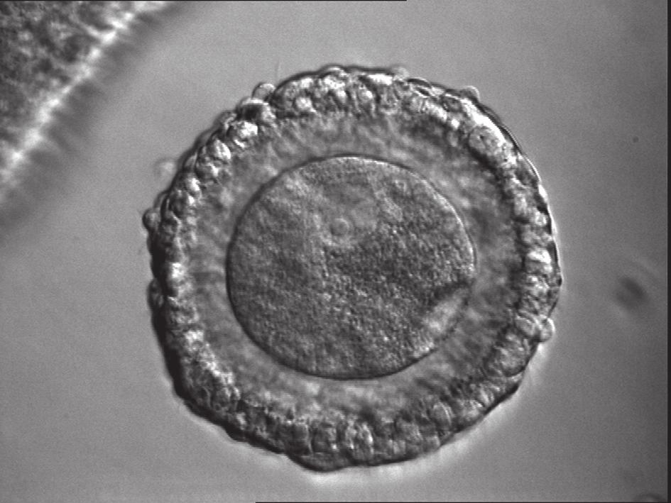 a b c Figure 2. Human immature oocytes at the time of retrieval.