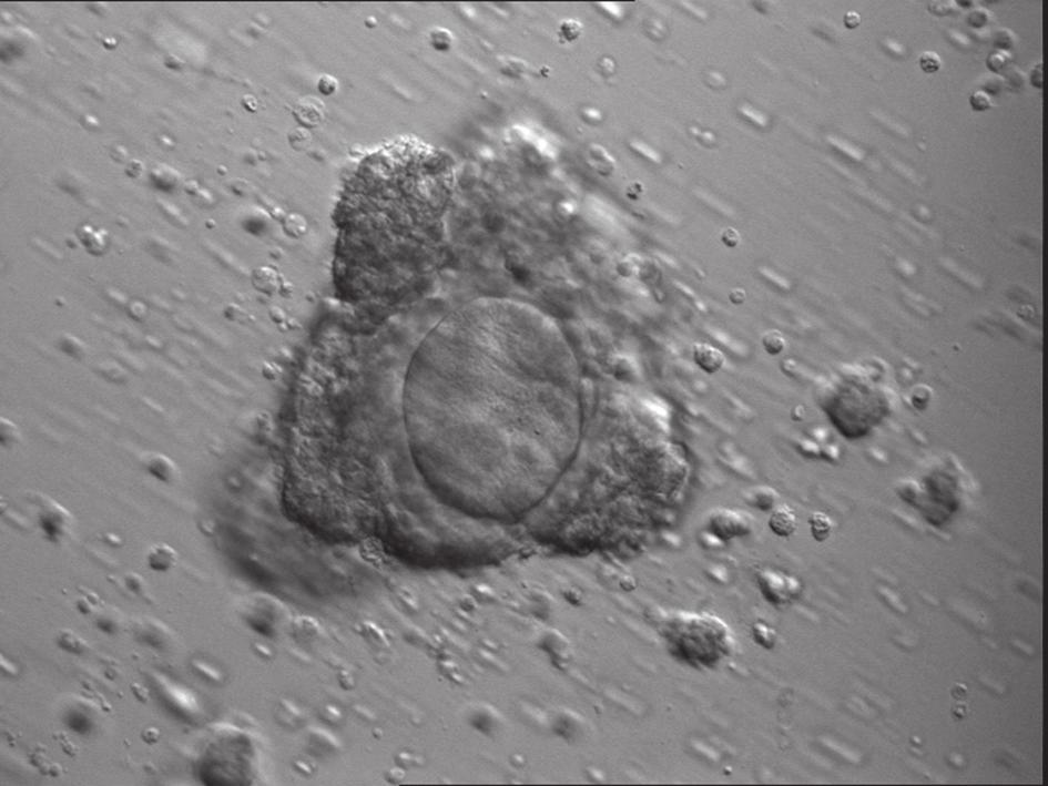 Cumulus cell expansion of metaphase II (MII)-stage oocytes retrieved