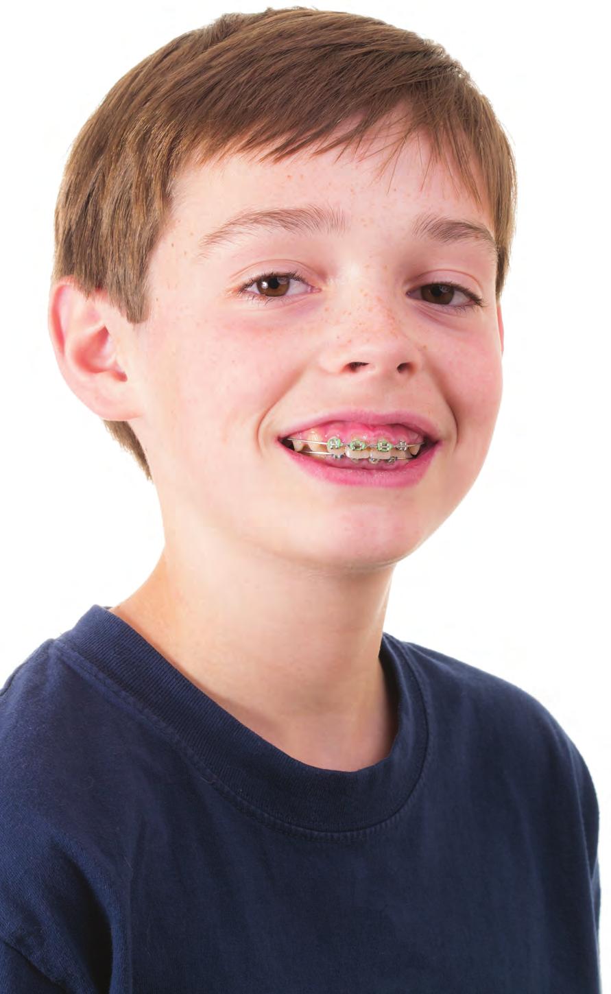 WHAT AGE SHOULD I BRING MY CHILD IN FOR AN ORTHODONTIC APPOINTMENT? Our specialist orthodontists can usually identify the age or whether your child may need braces.