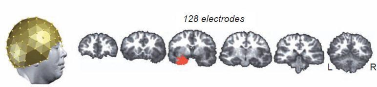 What you see in the EEG epileptic activity Seizure-related