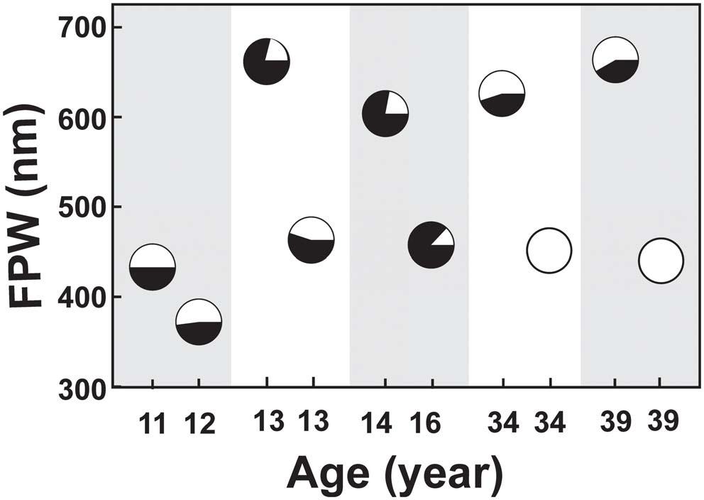 Figure 3. Relationship between age and % podocytes with no GL-3 in females. Dashed lines represent 0.95 confidence interval. doi:10.1371/journal.pone.0112188.