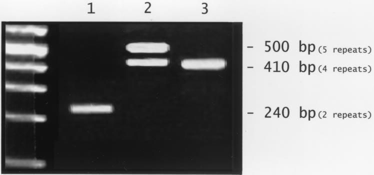 FIGURE 1 Photograph of a 3% agarose gel used to resolve the alleles 1, 2, and 3 of IL-1 RA. Lane 1: the homozygous allele 2 pattern (IL-1 RA 2/2 ).