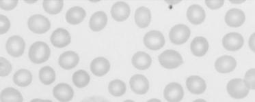 Blood platelet plasma erythrocyte leukocyte