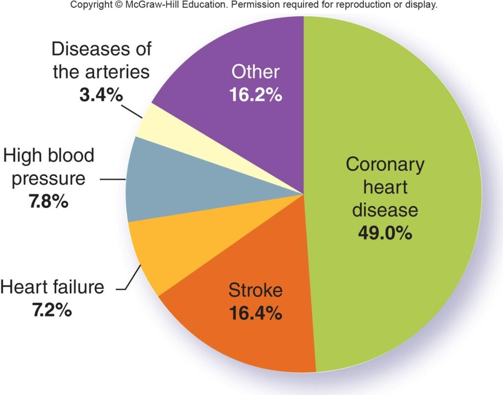CVD is a general term for diseases that include heart attack,