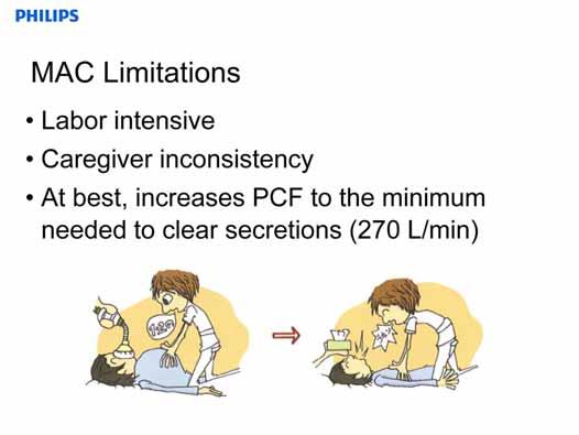 The limitations of MAC are that it can be labor intensive, inconsistency between caregivers, and MAC alone increases PCF only to the
