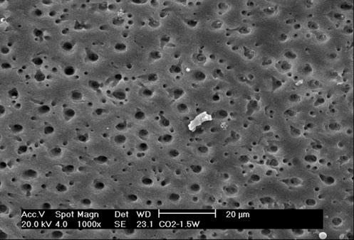40 Lasers Med Sci (2011) 26:35 42 Fig. 7 Electron micrograph representative of group 6 after CO 2 laser irradiation alone, with a power of 1 W.