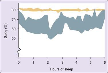 Average arterial oxygen saturation (Sao 2 ) in a sleeping subject at altitude (5360 m) without (blue
