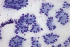 Normal Pancreas Acinar cells: two tone cytoplasm