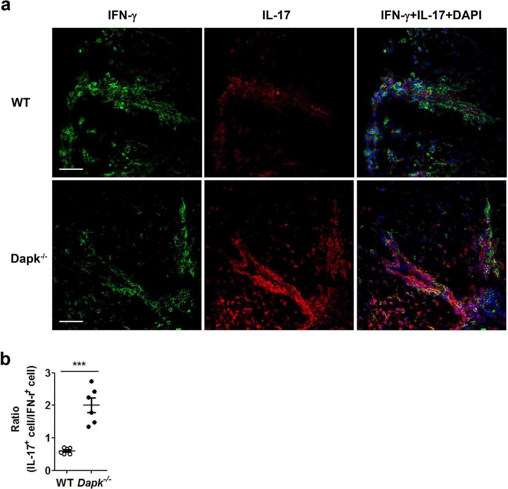 Supplementary Figure 4. Increased IL-17-expressing mononuclear cells in spinal cords from Dapk -/- mice sensitized for EAE generation.