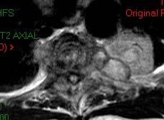 collection Axial MRI. T2-weighted.