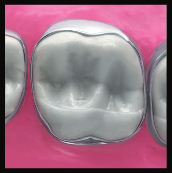 Mandibular  3M Oral Care Orthodontic Product