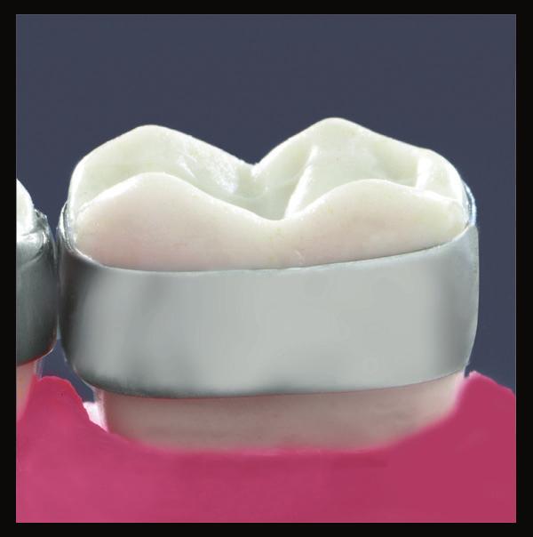 Mandibular Victory  3M Oral Care Orthodontic