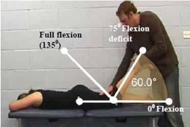 The neutral position (0 ) is also shown, as is the maximum amount of hip extension PROM that is permissible in order to meet this criterion (40 hip extension deficit).