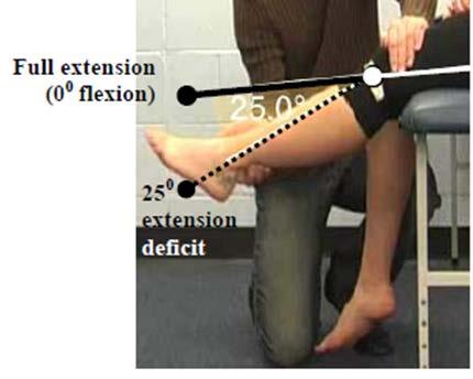 Secondary Criterion #5 20 ankle dorsi / plantar flexion available in the range between 10 dorsiflexion and 25 plantar flexion. Test conducted with knee in 90.