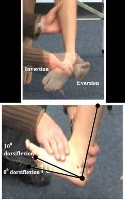 Primary Criterion #7 At least two of the following three muscle actions must have a loss of 3 points each: Ankle Dorsiflexion, Ankle Eversion, and Ankle Inversion.