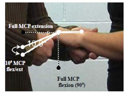 Criterion #6 Any four digits with 10 of flexion / extension at the metacarpophalangeal joint.