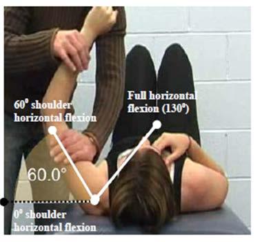 Primary Criteria for impaired muscle power Bilateral Upper limb Athletes are eligible if they meet ONE OR MORE of the following criteria: Criterion #1 Shoulder abduction loss of 3 muscle grade points