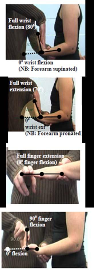 Criterion #7 Any two of the following four muscle actions must have a loss of 3 muscle grade points (i.e., muscle grade of 2): Wrist flexion; Wrist extension; Finger extension; Finger flexion.