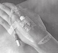 What are the risks with a cannula? any object, including a cannula, that breaks the skin has a risk of letting infection into the body.