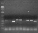 MW MW 1 2 3 4 5 6 7 8 9 10 11 12 850 500 300 100 Figure 2: Agarose gel electrophoresis showing the nested PCR products of the of 18S rrna gene (826-864 bp), diagnostic of Cryptosporidium species