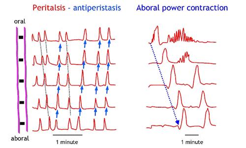 2. There are two abnormal motility patterns (Figure 2) a. Antiperistaltic contractions.